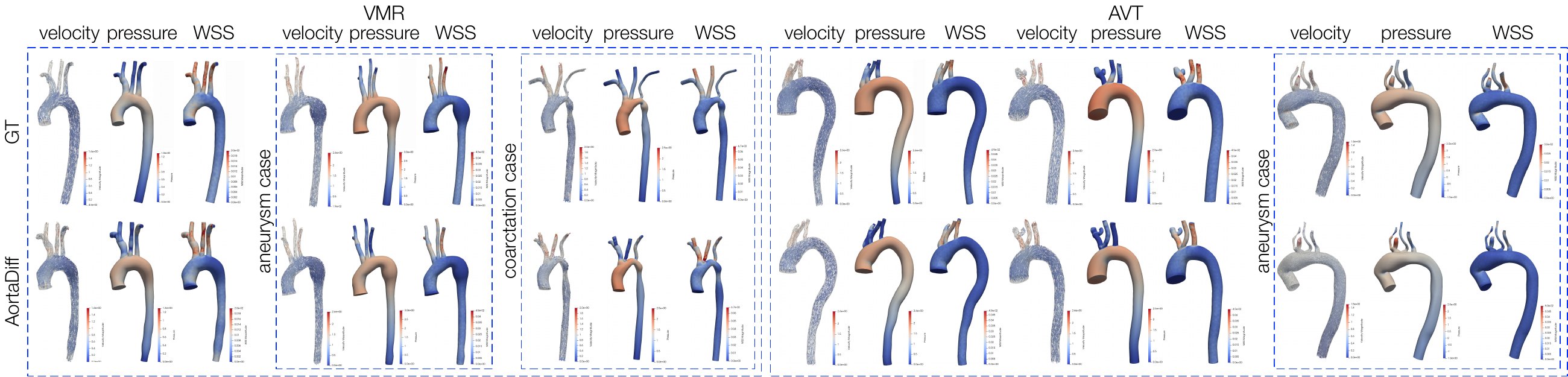 CFD comparison of velocity, pressure, and wall shear stress on generated and reference aortic meshes