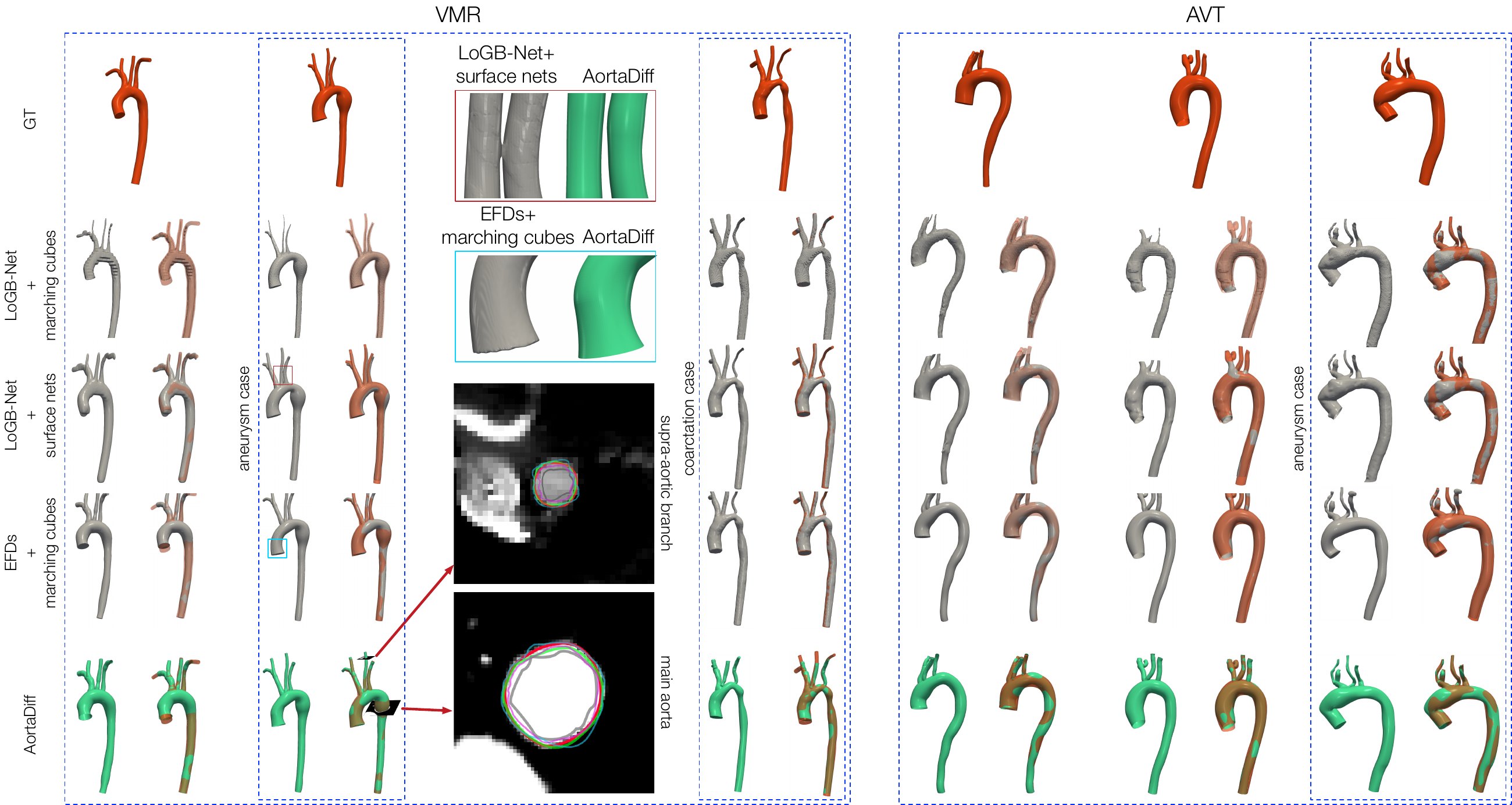 Qualitative comparison of generated aortic meshes across methods and reference meshes