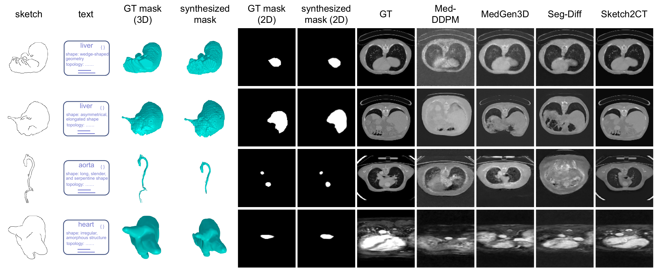 Comparison of Sketch2CT with Med-DDPM, MedGen3D, and Seg-Diff for liver CT, aorta CT, and heart MRI generation, alongside ground truth masks and images.