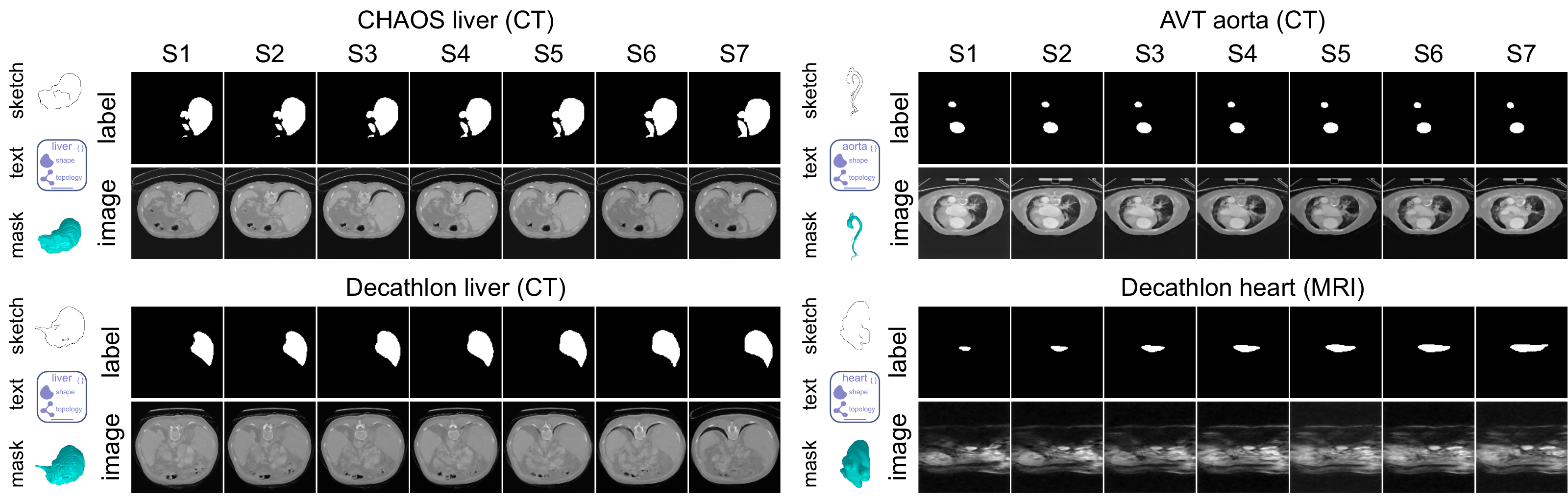 Sketch and text conditioned Sketch2CT results across CHAOS liver CT, AVT aorta CT, Decathlon liver CT, and Decathlon heart MRI, showing seven consecutive slices of each generated volume.