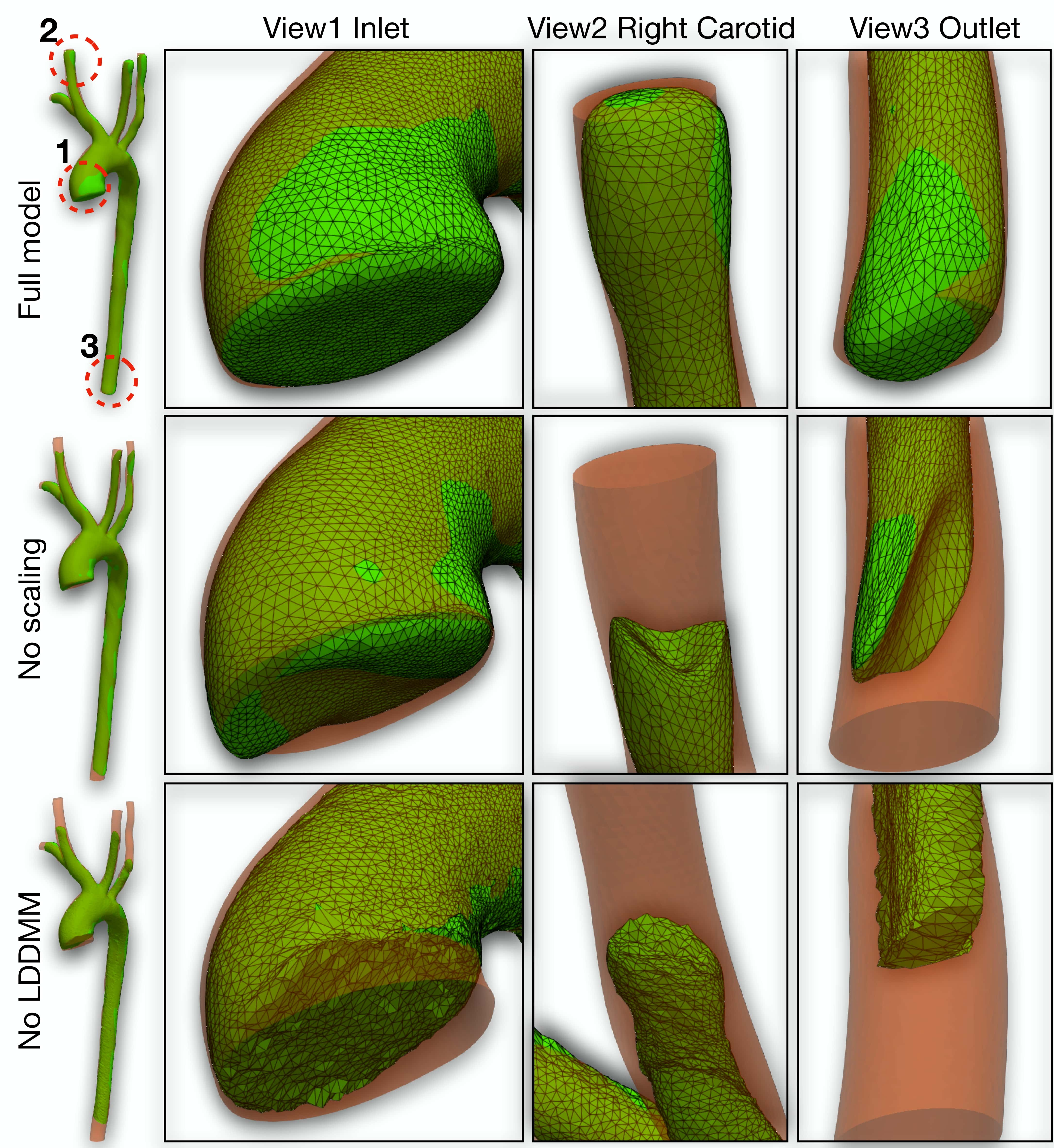 AI-powered automated model construction for patient-specific CFD simulations of aortic flows
