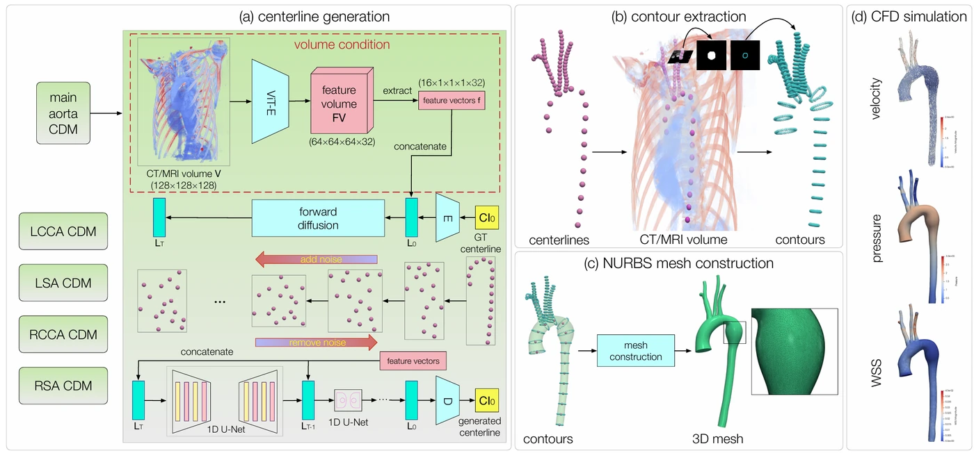 Visual abstract for AortaDiff: Volume-Guided Conditional Diffusion Models for Multi-Branch Aortic Surface Generation