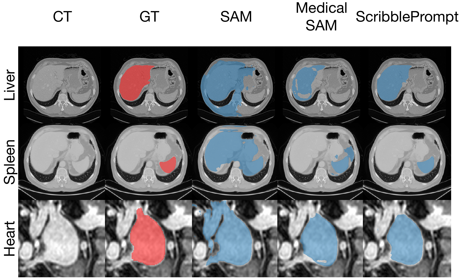 Sli2Vol+: Segmenting 3D medical images based on an object estimation guided correspondence flow network