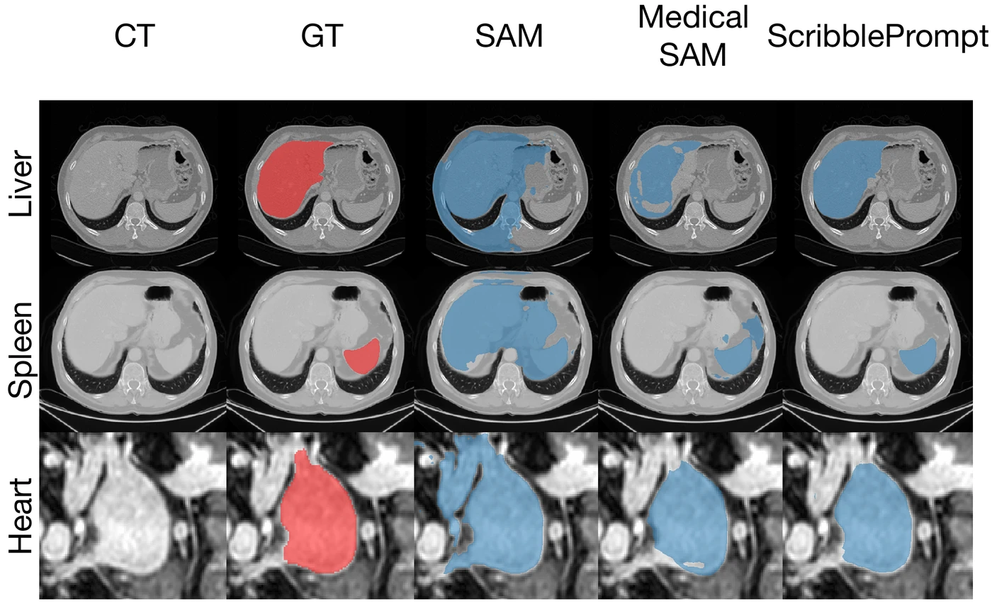 Visual abstract for Sli2Vol+: Segmenting 3D medical images based on an object estimation guided correspondence flow network